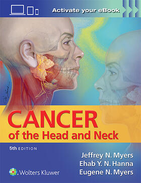 Myers / Hanna |  Cancer of the Head and Neck | Buch |  Sack Fachmedien