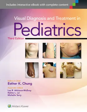 Chung |  Visual Diagnosis and Treatment in Pediatrics | Buch |  Sack Fachmedien