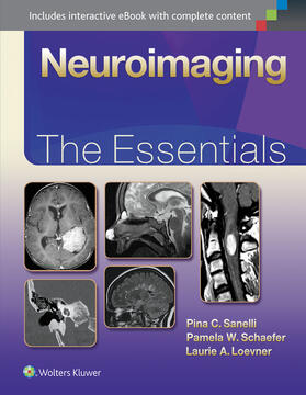 Sanelli / Schaefer / Loevner |  Neuroimaging: The Essentials | Buch |  Sack Fachmedien