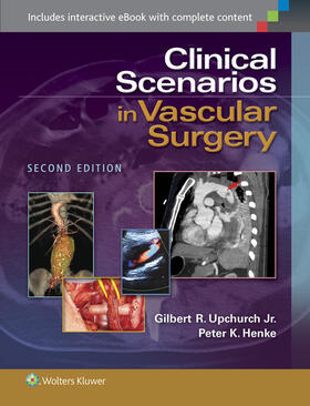 Upchurch / Henke | Clinical Scenarios in Vascular Surgery | Buch | 978-1-4511-9213-1 | sack.de