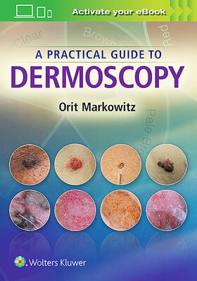 Markowitz | A Practical Guide to Dermoscopy | Buch | 978-1-4511-9263-6 | sack.de