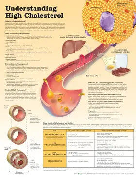 Moodie | Understanding High Cholesterol Lam | Sonstiges | 978-1-4511-9324-4 | sack.de