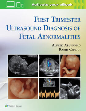 Abuhamad / Chaoui |  First Trimester Ultrasound Diagnosis of Fetal Abnormalities | Buch |  Sack Fachmedien