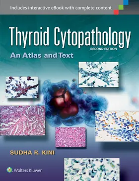 Kini |  Thyroid Cytopathology | Buch |  Sack Fachmedien