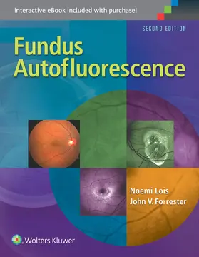 Lois / Forrester |  Fundus Autofluorescence | Buch |  Sack Fachmedien