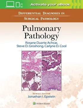 Achcar / Groshong / Cool |  Differential Diagnoses in Surgical Pathology: Pulmonary Pathology | Buch |  Sack Fachmedien