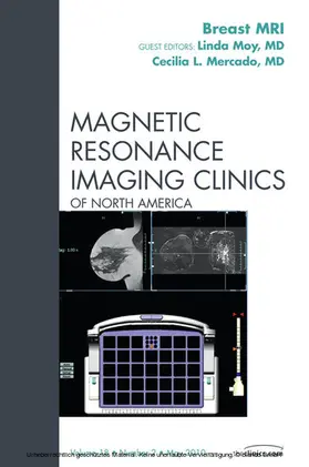 Moy / Mercado |  Breast MRI, An Issue of Magnetic Resonance Imaging Clinics | eBook | Sack Fachmedien