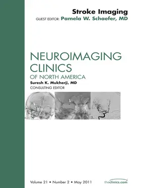 Schaefer MD / Gean |  Imaging of Ischemic Stroke, An Issue of Neuroimaging Clinics | eBook | Sack Fachmedien