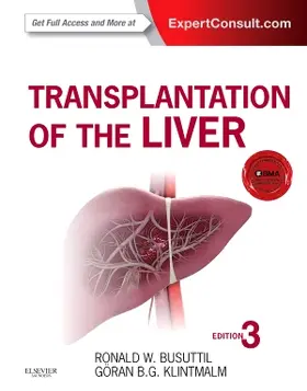 Busuttil / Klintmalm |  Transplantation of the Liver | Buch |  Sack Fachmedien