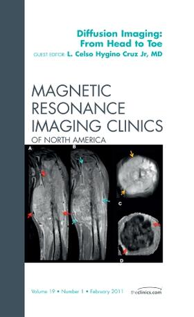 Hygino |  Clinical Applications of Diffusion Imaging: from Head to Toe | Buch |  Sack Fachmedien