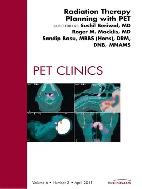 Beriwal MD / Beriwal |  Radiation Therapy Planning, An Issue of PET Clinics | eBook | Sack Fachmedien