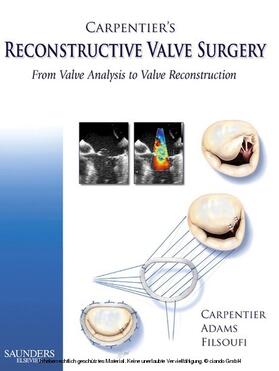 Carpentier / Filsoufi |  Carpentier's Reconstructive Valve Surgery | eBook | Sack Fachmedien