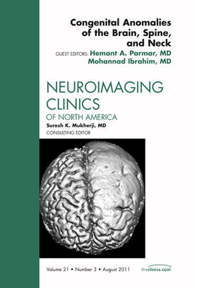 Parmar / Ibrahim |  Congenital Anomalies of the Brain, Spine, and Neck, an Issue of Neuroimaging Clinics | Buch |  Sack Fachmedien