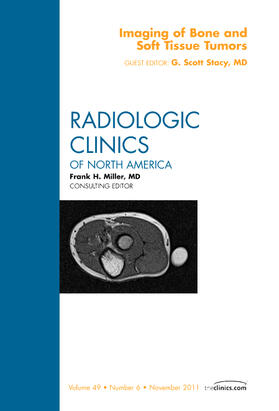 Stacy |  Imaging of Bone and Soft Tissue Tumors, an Issue of Radiologic Clinics of North America | Buch |  Sack Fachmedien