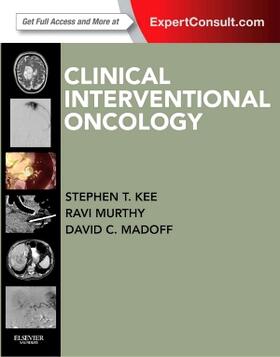 Kee / Madoff / Murthy |  Clinical Interventional Oncology | Buch |  Sack Fachmedien