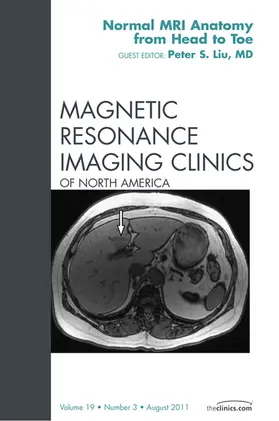 Liu MD |  Normal MR Anatomy, An Issue of Magnetic Resonance Imaging Clinics | eBook | Sack Fachmedien