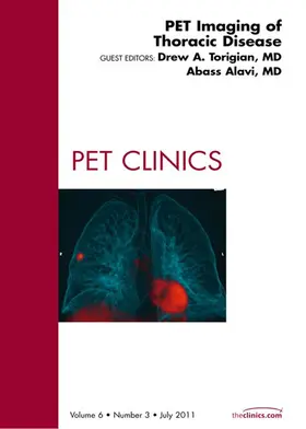 Torigian MD / Alavi MD / Alavi |  PET Imaging of Thoracic Disease, An Issue of PET Clinics | eBook | Sack Fachmedien