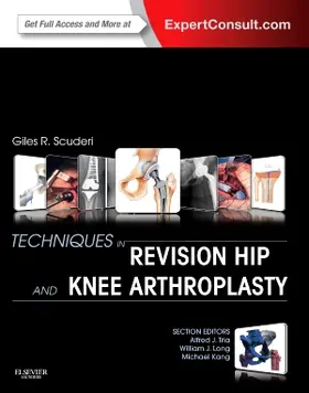 Scuderi |  Techniques in Revision Hip and Knee Arthroplasty | Buch |  Sack Fachmedien