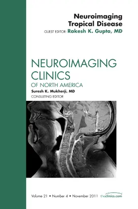 Gupta |  Neuroimaging Tropical Disease, an Issue of Neuroimaging Clinics | Buch |  Sack Fachmedien