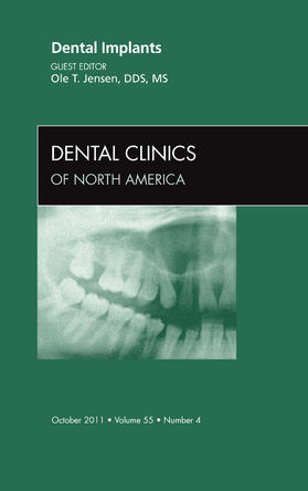 Jensen |  Dental Implants, an Issue of Dental Clinics | Buch |  Sack Fachmedien