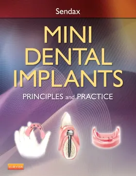 Sendax |  Mini Dental Implants | Buch |  Sack Fachmedien