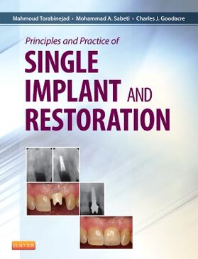 Torabinejad / Sabeti / Goodacre |  Principles and Practice of Single Implant and Restoration | Buch |  Sack Fachmedien