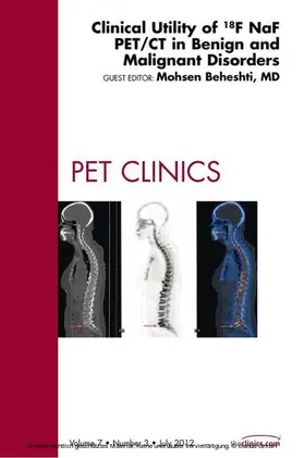 Beheshti |  Clinical Utility of 18NaF PET/CT in Benign and Malignant Disorders, An Issue of PET Clinics | eBook | Sack Fachmedien