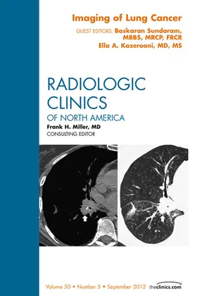 Kazerooni / Sundaram |  Imaging of Lung Cancer, An Issue of Radiologic Clinics of North America | eBook | Sack Fachmedien