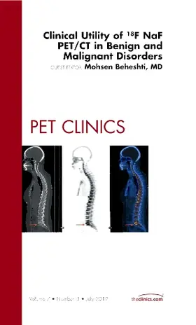 Beheshti |  Clinical Utility of 18naf Pet/CT in Benign and Malignant Disorders, an Issue of Pet Clinics | Buch |  Sack Fachmedien