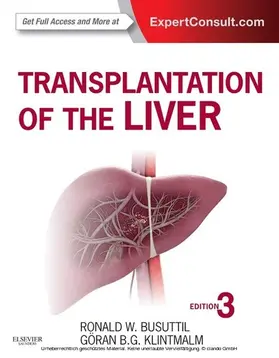 Busuttil / Klintmalm |  Transplantation of the Liver | eBook | Sack Fachmedien