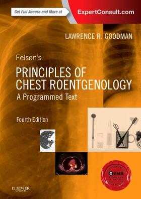 Goodman |  Felson's Principles of Chest Roentgenology | Buch |  Sack Fachmedien