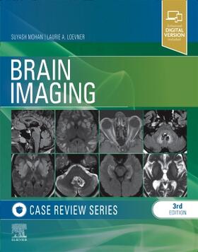 Mohan / Loevner |  Brain Imaging: Case Review Series | Buch |  Sack Fachmedien