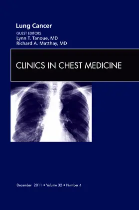 Tanoue / Matthay |  Lung Cancer, an Issue of Clinics in Chest Medicine | Buch |  Sack Fachmedien