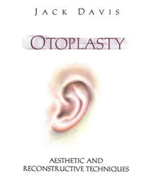 Davis |  Otoplasty | eBook | Sack Fachmedien