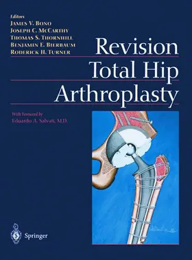 Bono / McCarthy / Turner |  Revision Total Hip Arthroplasty | Buch |  Sack Fachmedien