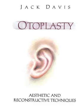 Davis | Otoplasty | Buch | 978-1-4612-7484-1 | sack.de