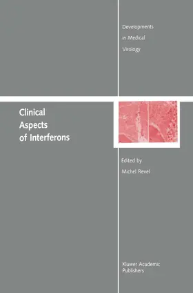 Revel |  Clinical Aspects of Interferons | Buch |  Sack Fachmedien