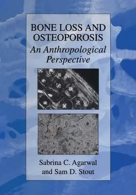 Stout / Agarwal |  Bone Loss and Osteoporosis | Buch |  Sack Fachmedien