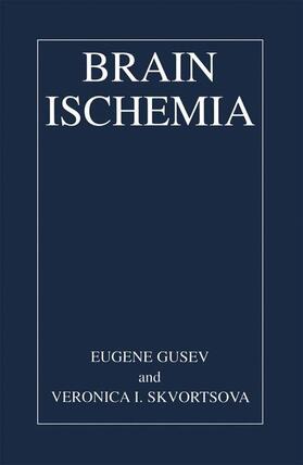 Skvortsova / Gusev |  Brain Ischemia | Buch |  Sack Fachmedien