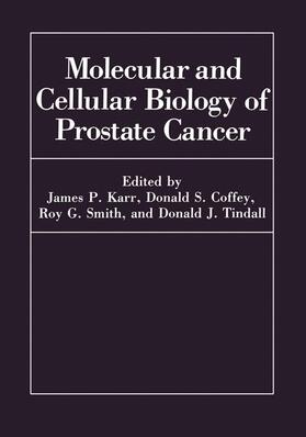 Coffey / Tindall / Karr |  Molecular and Cellular Biology of Prostate Cancer | Buch |  Sack Fachmedien