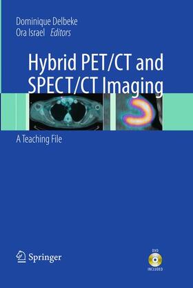 Delbeke / Israel |  Hybrid Pet/CT and Spect/CT Imaging | Buch |  Sack Fachmedien