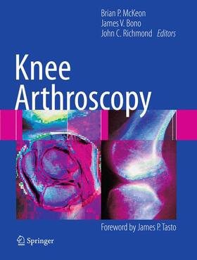 McKeon / Bono / Richmond |  Knee Arthroscopy | Buch |  Sack Fachmedien