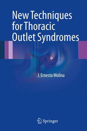 Molina |  New Techniques for Thoracic Outlet Syndromes | Buch |  Sack Fachmedien