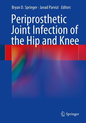 Springer / Parvizi |  Periprosthetic Joint Infection of the Hip and Knee | eBook | Sack Fachmedien