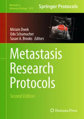 Dwek / Schumacher / Brooks |  Metastasis Research Protocols | eBook | Sack Fachmedien