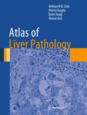 Chan / Burt / Quaglia |  Atlas of Liver Pathology | Buch |  Sack Fachmedien