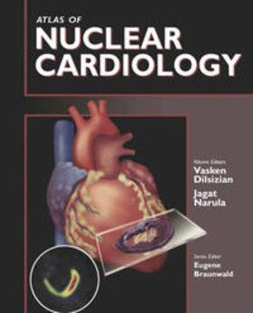 Dilsizian / Narula / Braunwald |  Atlas of Nuclear Cardiology | eBook | Sack Fachmedien