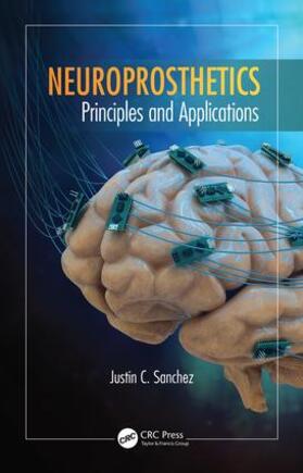 Sanchez |  Neuroprosthetics | Buch |  Sack Fachmedien