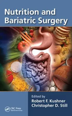 Kushner / Still |  Nutrition and Bariatric Surgery | Buch |  Sack Fachmedien