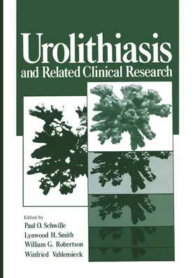 Schwille / Vahlensieck / Smith |  Urolithiasis and Related Clinical Research | Buch |  Sack Fachmedien